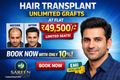 Book Hair transplant @ Rs 4950